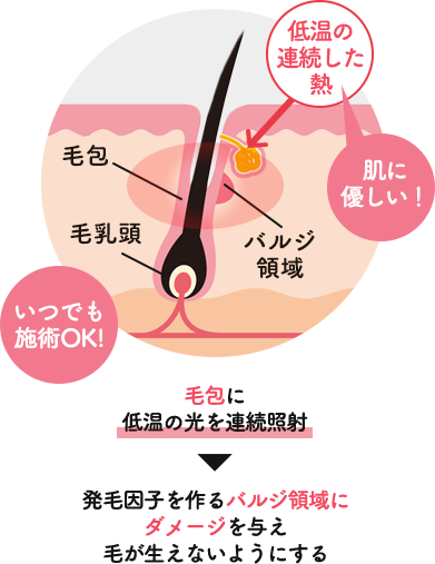 LUMIX-A9 SHR脱毛は