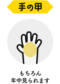 手の甲